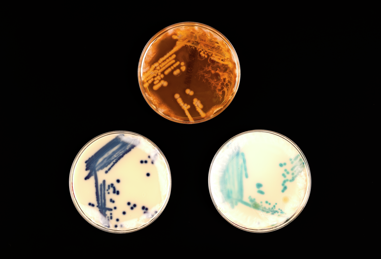 Супермикробы: борьба за жизнь – афиша